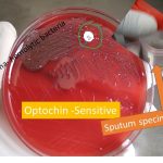 Optochin sensitivity test