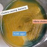 Vibrio cholerae on TCBS agar