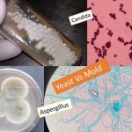 Fungus:Yeast Vs mold-colonial and microscopic features