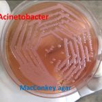 Acinetobacter on MacConkey agar