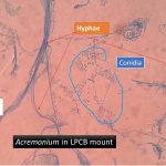 Acremonium in LPCB mount