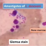 Amastigotes of Leishmania donovani
