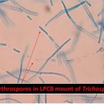 Arthrospores in LPCB mount of Trichosporon