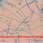 Arthrospores of fungus