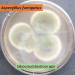 Aspergillus fumigatus on SDA