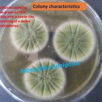 Aspergillus fumigatus colony characteristics