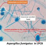 Aspergillus fumigatus in LPCB