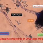 Aspergillus structures