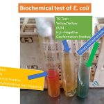 Biochemical test of E. coli