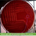 Blood agar