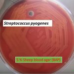 Blood agar