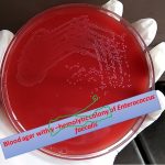 Blood agar