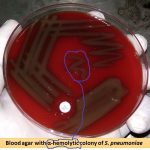 Blood agar