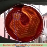 Blood agar with haemodigestion