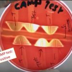 CAMP test