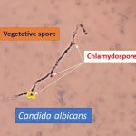 Chlamydospore