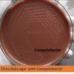 Chocolate agar