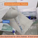 Cholera dipstick test positive