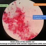 Conidia of Apergillus in gram stain