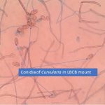 Conidia of Curvularia in LPCB mount