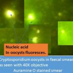 Cryptosporidium oocyts in Auramine o stain