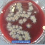 Curvularia on blood agar