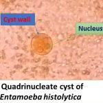Cyst of Entamoeba histolytica or dispar