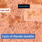 Cyst of Giardia lamblia