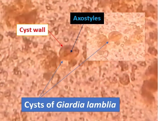 Cyst of Giardia lamblia