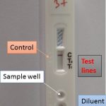 Dengue rapid test