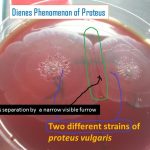 Dienes phenomenon of Proteus