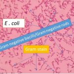 E. coli in gram stain