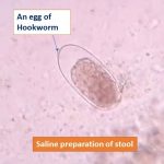 Egg of Hookworm in saline preparation