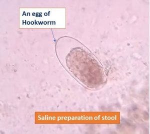 Hookworm Egg in saline preparation: Introduction, Life cycle, Pathogenecit