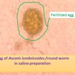 Fertilized egg Ascaris or roundworm