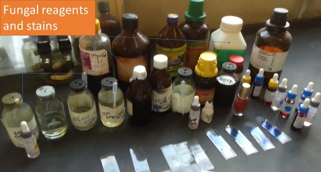 Fungal Reagent and Stains: Introduction, List and Their Uses