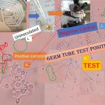 Germ tube test (GTT)