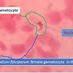 Gametocyte of plasmodium falciparum