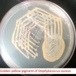 Golden yellow pigment of Staphylococcus aureus