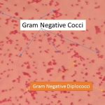 Gram negative diplococci bacteria