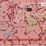 Gram positive bacteria in Gram stain