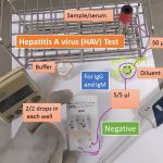 HAV test