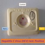 HCV test positive