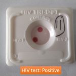 HIV test positive