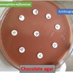 Haemophilus influenzae antibiotic sensitivity testing in chocolate agar