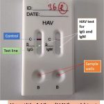 Hepatitis A virus (HAV) rapid test