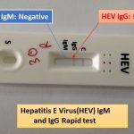 Hepatitis E Virus(HEV) rapid test