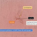 Hypahe, conidia and conidiophores of Ochroconis gallopava
