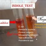 Indole test