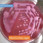 Klebsiella pneumoniae on MacConkey agar